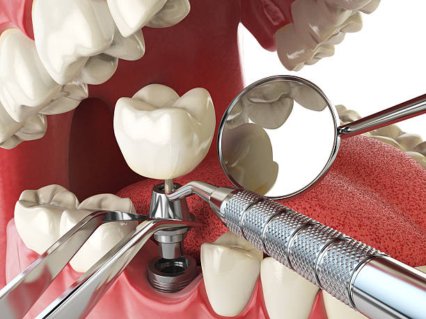 Fast & Reliable Emergency Dental Services in NH
